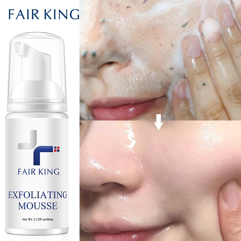 Foaming Exfoliating Mousse Deep Remove Cleaning All Skin Types Wash Face