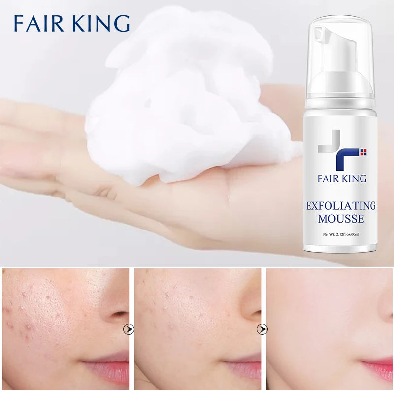 Foaming Exfoliating Mousse Deep Remove Cleaning All Skin Types Wash Face